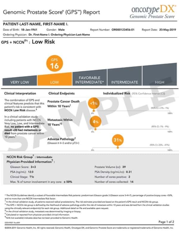 OncotypeDx Results PC Markers